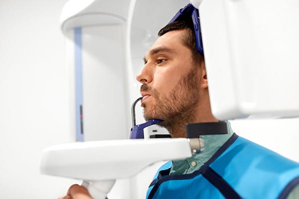 implant-consultation-scanning implant consultation scanning