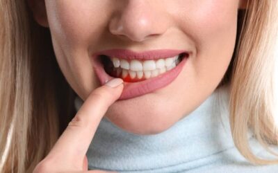 Periodontal disease and its Treatment Options: Everything You Need to Know