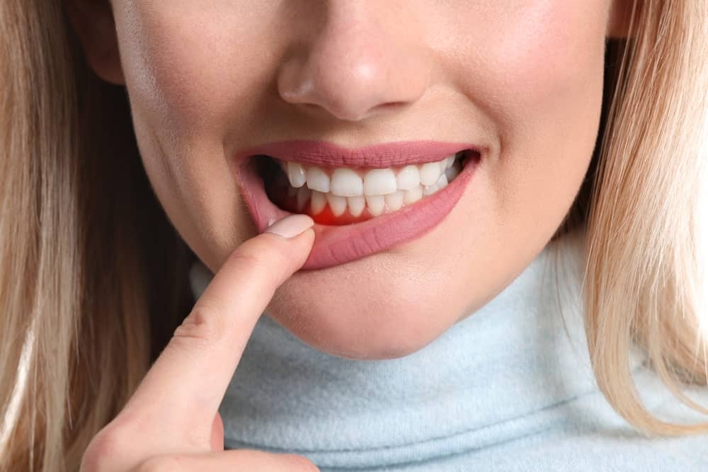 woman gum inflammation closeup